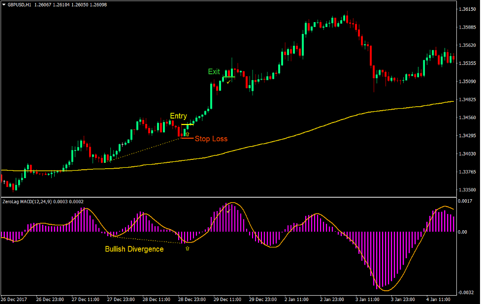 MACD Divergence Forex Trading Strategy 2